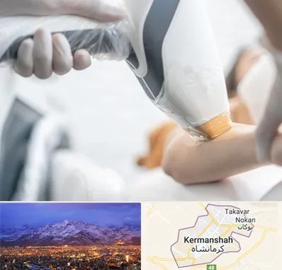 تجهیزات پزشکی زیبایی در کرمانشاه