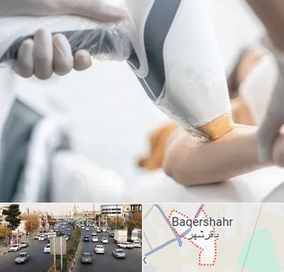 تجهیزات پزشکی زیبایی در باقرشهر