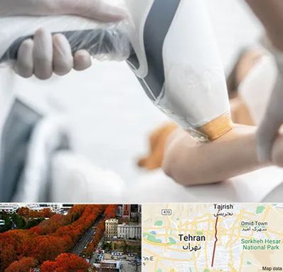 تجهیزات پزشکی زیبایی در ولیعصر 