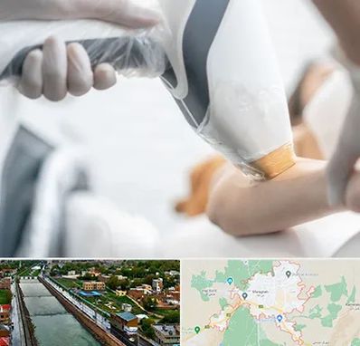 تجهیزات پزشکی زیبایی در مراغه