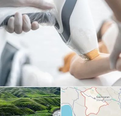 تجهیزات پزشکی زیبایی در گچساران