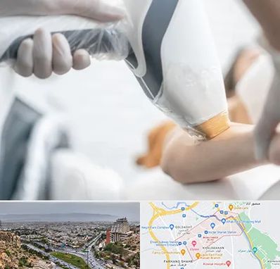 تجهیزات پزشکی زیبایی در معالی آباد شیراز