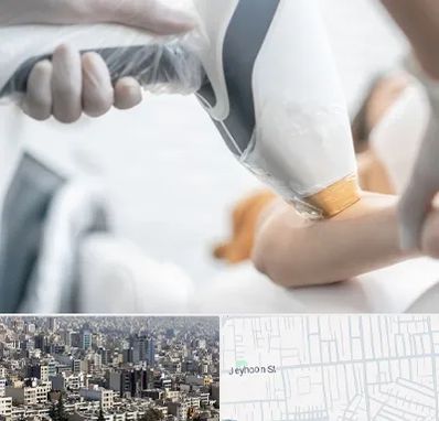 تجهیزات پزشکی زیبایی در جیحون