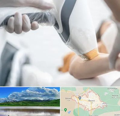 تجهیزات پزشکی زیبایی در مرند