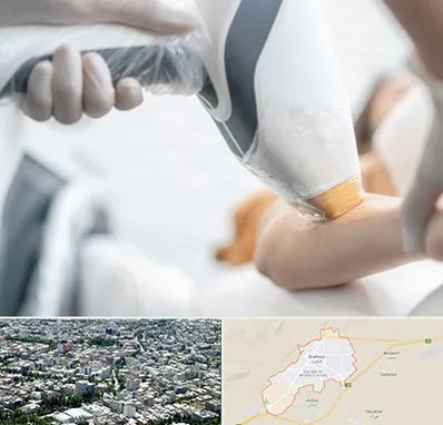تجهیزات پزشکی زیبایی در شاهرود
