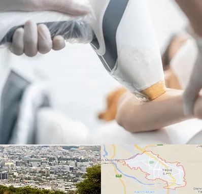 تجهیزات پزشکی زیبایی در یاسوج