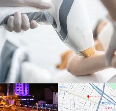 تجهیزات پزشکی زیبایی در آبرسان تبریز