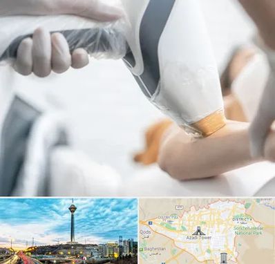 تجهیزات پزشکی زیبایی در تهران