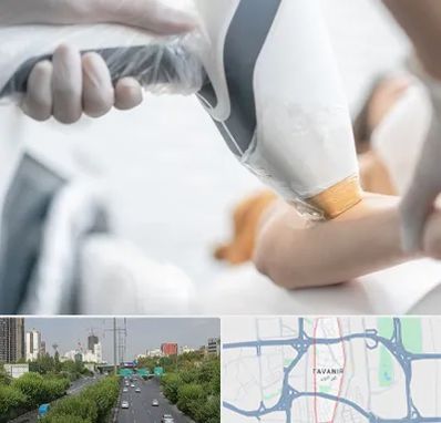 تجهیزات پزشکی زیبایی در توانیر