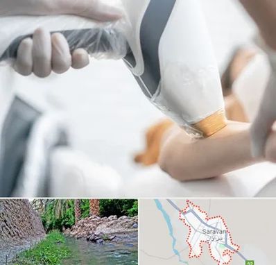 تجهیزات پزشکی زیبایی در سراوان