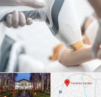 تجهیزات پزشکی زیبایی در باغ فردوس