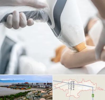 تجهیزات پزشکی زیبایی در بندر ترکمن