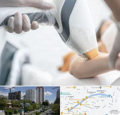 تجهیزات پزشکی زیبایی در اندرزگو