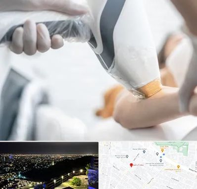 تجهیزات پزشکی زیبایی در هفت تیر مشهد 