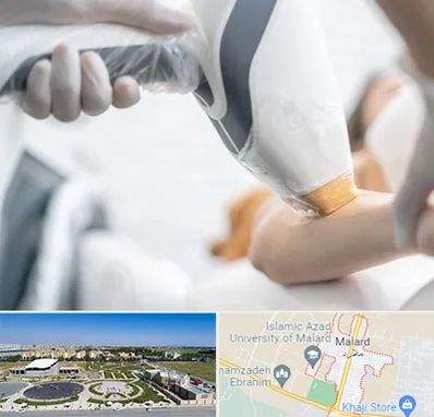 تجهیزات پزشکی زیبایی در ملارد