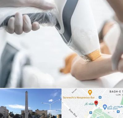 تجهیزات پزشکی زیبایی در فلکه گاز شیراز