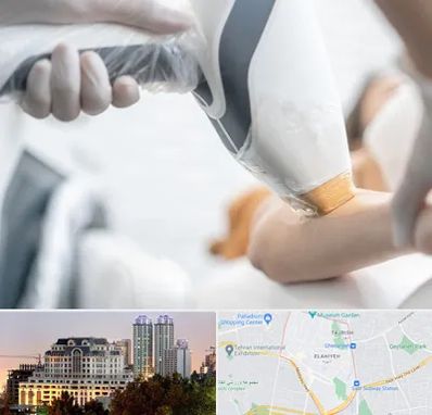 تجهیزات پزشکی زیبایی در فرشته 