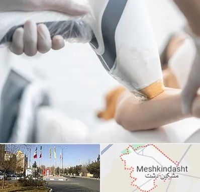 تجهیزات پزشکی زیبایی در مشکین دشت