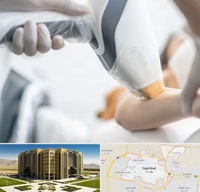 تجهیزات پزشکی زیبایی در نجف آباد