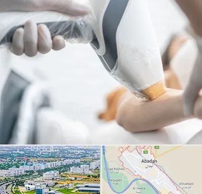 تجهیزات پزشکی زیبایی در آبادان