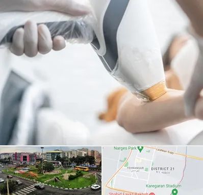 تجهیزات پزشکی زیبایی در تهرانسر 