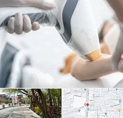 تجهیزات پزشکی زیبایی در خیابان توحید اصفهان