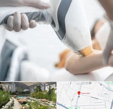 تجهیزات پزشکی زیبایی در بلوار تعاون