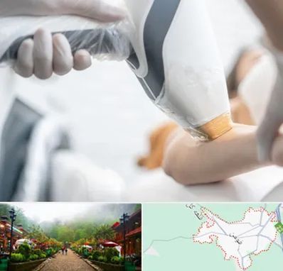 تجهیزات پزشکی زیبایی در فومن