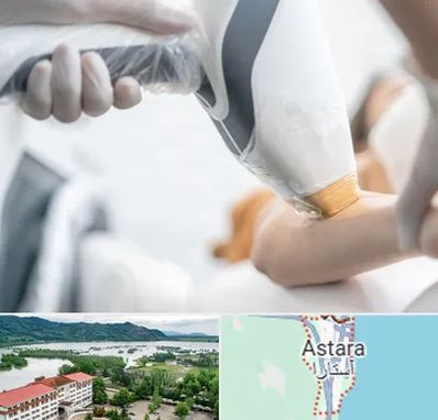 تجهیزات پزشکی زیبایی در آستارا