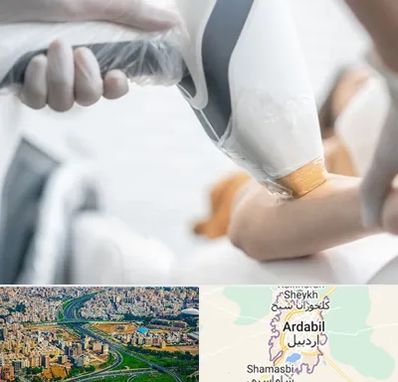 تجهیزات پزشکی زیبایی در اردبیل