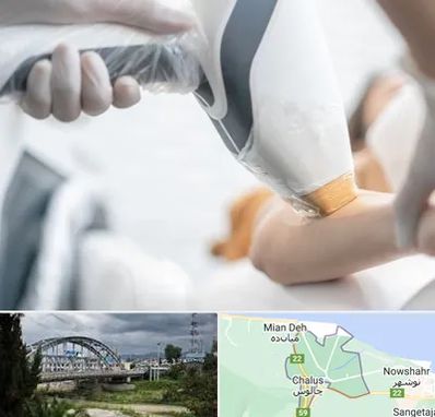 تجهیزات پزشکی زیبایی در چالوس