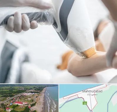 تجهیزات پزشکی زیبایی در محمودآباد