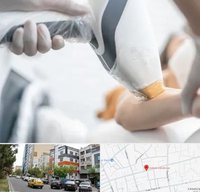 تجهیزات پزشکی زیبایی در هفده شهریور تبریز