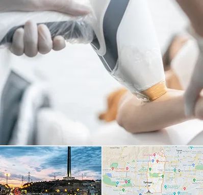 تجهیزات پزشکی زیبایی در منطقه 2 تهران 