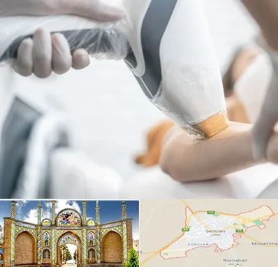 تجهیزات پزشکی زیبایی در سمنان