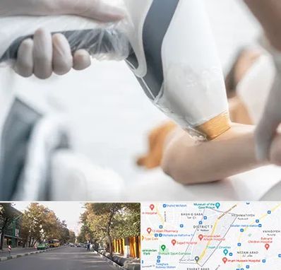 تجهیزات پزشکی زیبایی در شریعتی 