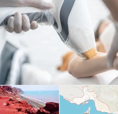 تجهیزات پزشکی زیبایی در هرمزگان