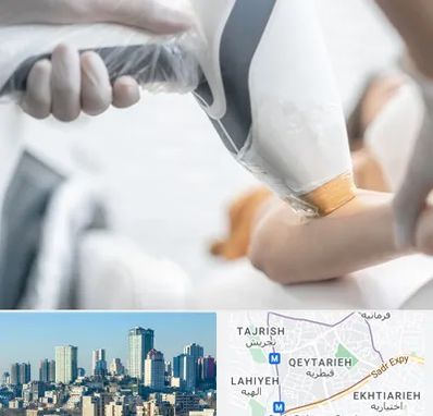 تجهیزات پزشکی زیبایی در قیطریه 