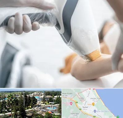 تجهیزات پزشکی زیبایی در رودسر