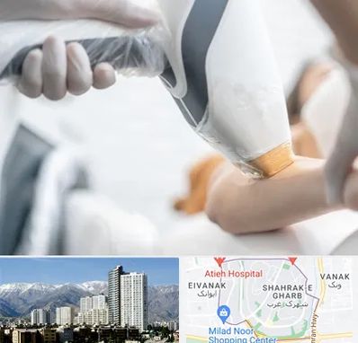 تجهیزات پزشکی زیبایی در شهرک غرب 