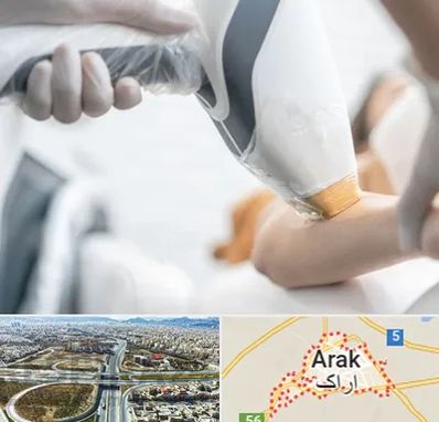 تجهیزات پزشکی زیبایی در اراک