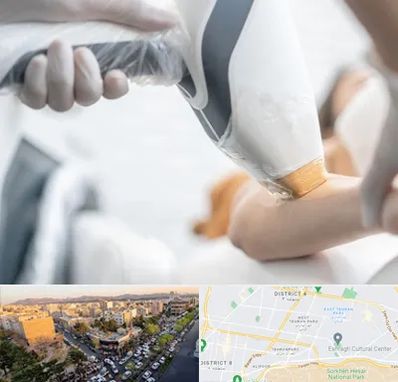 تجهیزات پزشکی زیبایی در تهرانپارس 