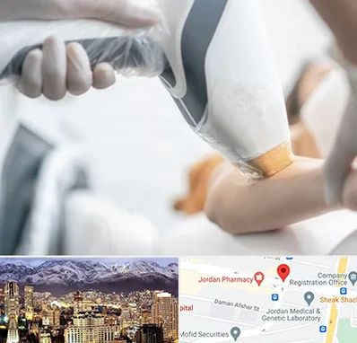 تجهیزات پزشکی زیبایی در جردن 