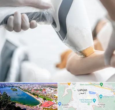 تجهیزات پزشکی زیبایی در لاهیجان