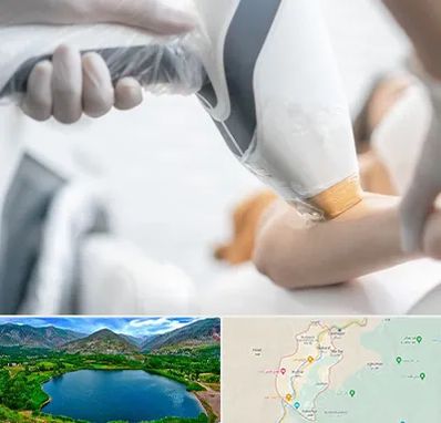 تجهیزات پزشکی زیبایی در رودبار