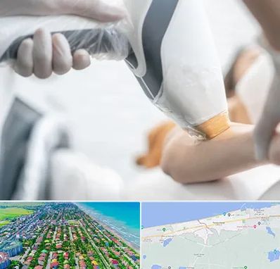 تجهیزات پزشکی زیبایی در فریدونکنار