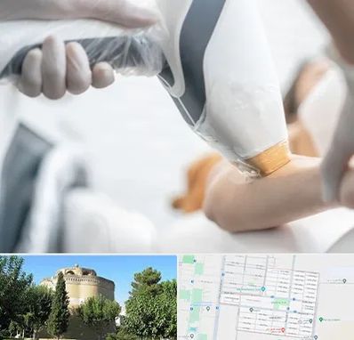 تجهیزات پزشکی زیبایی در مرداویج اصفهان