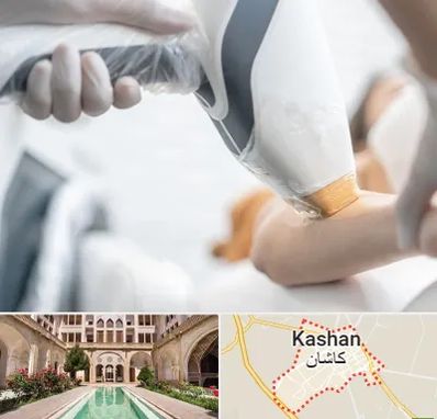 تجهیزات پزشکی زیبایی در کاشان