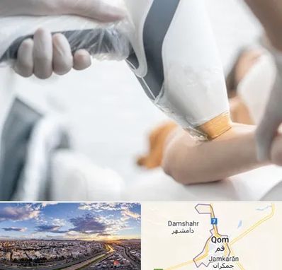 تجهیزات پزشکی زیبایی در قم