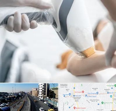 تجهیزات پزشکی زیبایی در پیروزی 